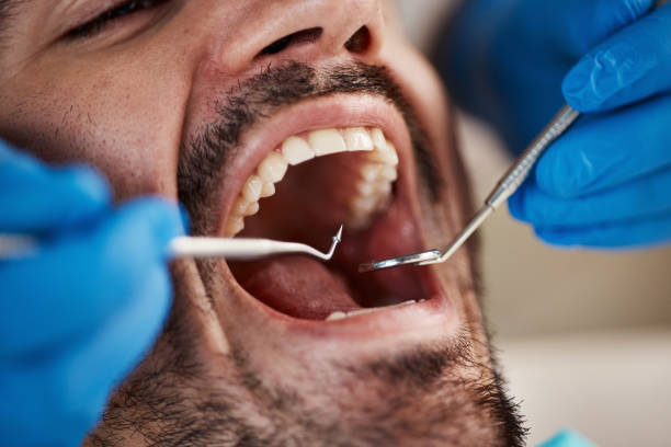 Best Urgent Care for Lost Fillings or Crowns in Albany, GA